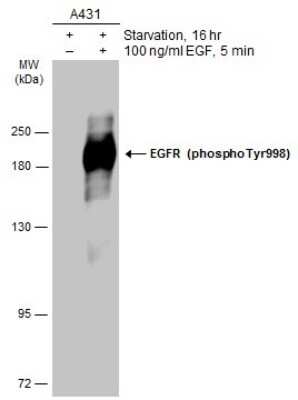 Western Blot: EGFR [p Tyr998] Antibody [NBP3-13227] - Untreated (-) and treated (+) A431 whole cell extract (30 ug) were separated by 7.5% SDS-PAGE, and the membrane was blotted with EGFR (phospho Tyr998) antibody (NBP3-13227) diluted at 1:2000. The HRP-conjugated anti-rabbit IgG antibody (NBP2-19301) was used to detect the primary antibody.